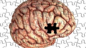 Cerebro Puzzle