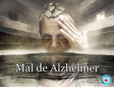 ALZHEIMER, LA PLAGA QUE VIENE